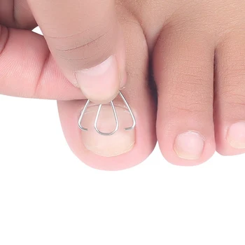 Инструмент для коррекции вросшего ногтя на ноге Ногти на ногте Ортез для ногтей на ногах Зажим для паронихии