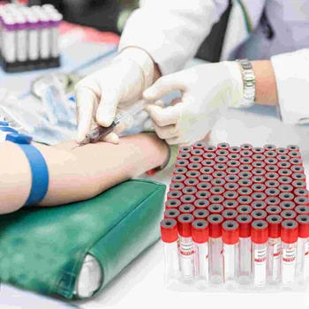 Одноразовая пробирка для сбора крови Лабораторное оборудование Стеклянные трубки с отрицательным давлением Вакуумный коллектор Клеевая головка